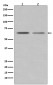 Anti-ER alpha ESR1 Rabbit Monoclonal Antibody